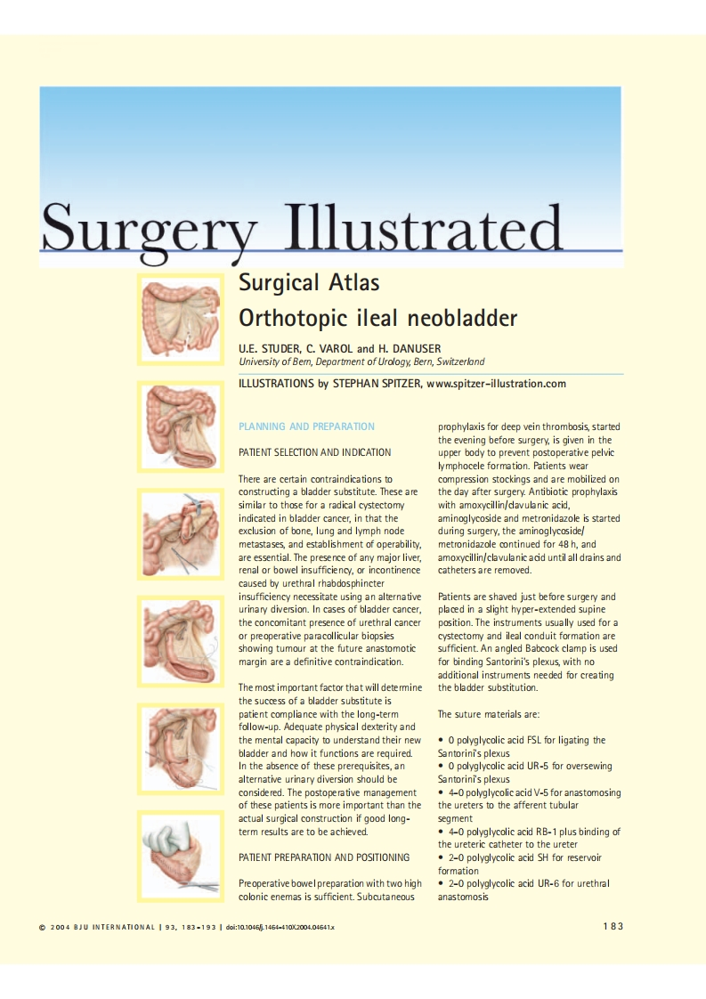 Surgical_Images_of_Ileal_conduit