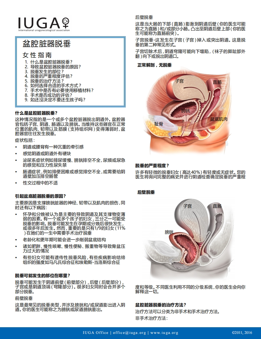 pelvic-organ-prolapse-chinese
