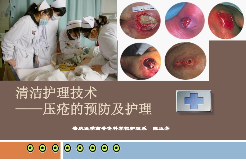 压疮的护理2021
