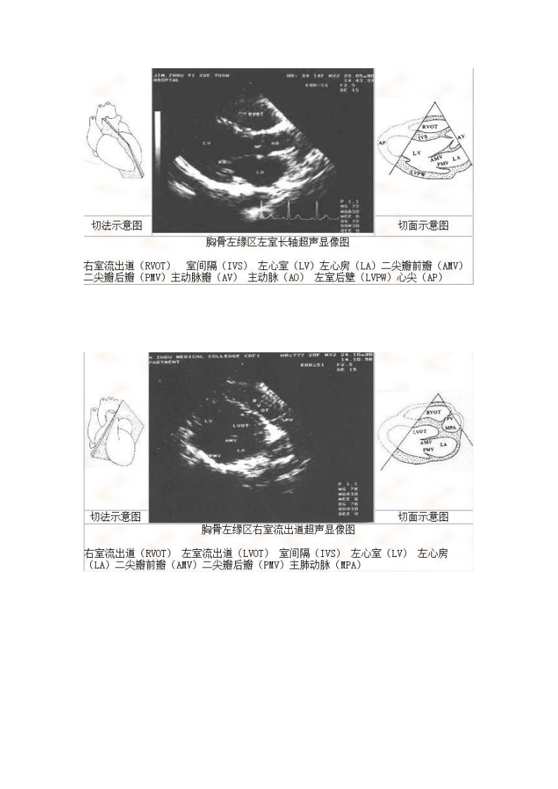 心脏标准切面影像