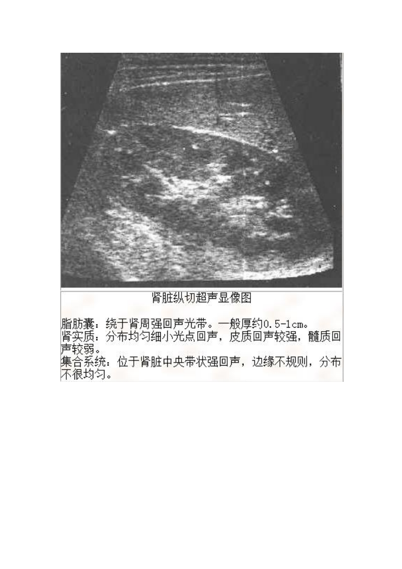 肾脏标准切面影像
