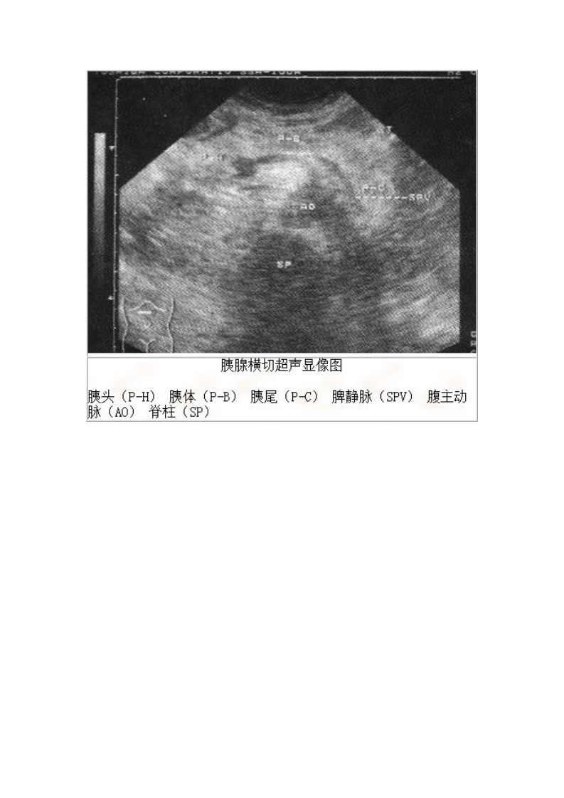 胰腺标准切面影像
